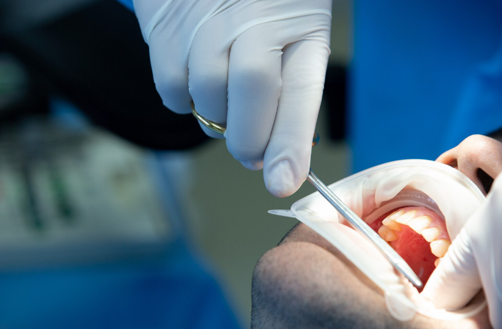 Endodoncia en Valladolid
