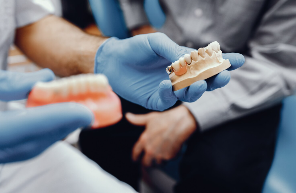 Implante dental en Valladolid: ¿cuánto dura realmente y qué cuidados necesita para que no falle?